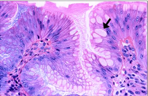 Pseudogoblet Cells Are Goblet Shaped Gastric Foveolar Cells Black