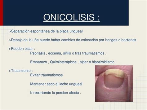 Patología Ungueal Patologia De La UÑa Onicomicosis Tratamiento Onic