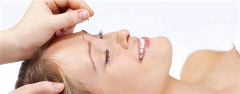 Cosmetic Acupuncture Tcm Acupuncture