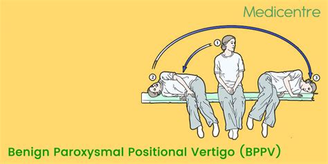 Benign Paroxysmal Positional Vertigo Bppv Causes Symptoms And Treatments