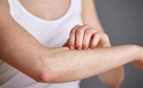 Treating Chronic Itch Therapeutic Review Dermatology Advisor