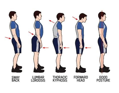 Anatomical movements 19 classification, naming & examination of muscles 25 myotomes 27 muscle innervation at the spinal cord level 28 ra. Is My Posture Bad? - Optimal Chiropractic