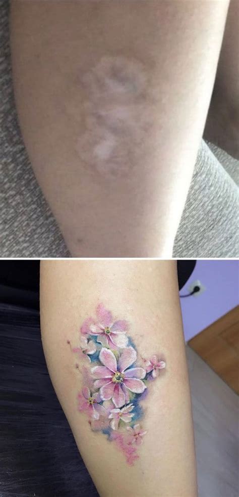 20 Tattoos That Turned Scars And Birthmarks Into Works Of Art Trulymind