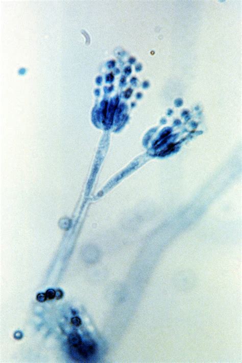 Public Domain Picture Magnified At 1200x This 1971 Photomicrograph Depicted Two Conidiophores