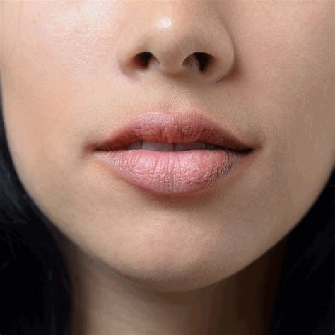 What Causes Red Rash On Lips