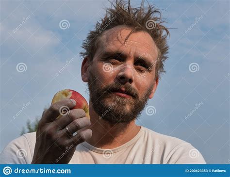 Man With Spotted Face Eating Apple Stock Image Image Of Color Person