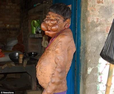 And whether it's for his birthday, graduation, or just to show you love him, getting the right gift for a 13 year old boy can be a challenge as the young man's interests change markedly. 16 year-old Indian boy covered in large swollen lumps ...
