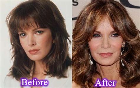 Jaclyn Smith Plastic Surgery You Can Download Jaclyn Smith Flickr