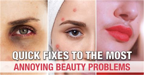 12 Most Annoying Beauty Problems All Women Face And How To Fix Them