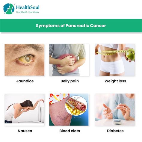 Pancreatic Cancer Symptoms And Treatment Healthsoul