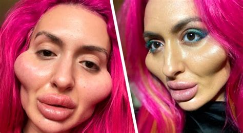 She Is 32 Years Old And Addicted To Cosmetic Surgery She Spent £1600 To Have The World S