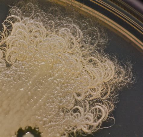 Bacillus Mycodies Seen From An Environmental Swab Grown On Tsa At 37