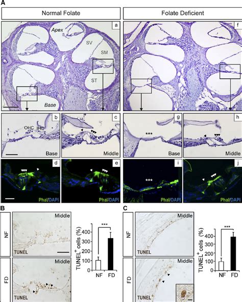 Fd Mice Showed Altered Cochlear Morphology And Apoptotic Cells