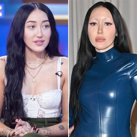 Did Noah Cyrus Ever Have Plastic Surgery See The Singer’s Transformation Over The Years