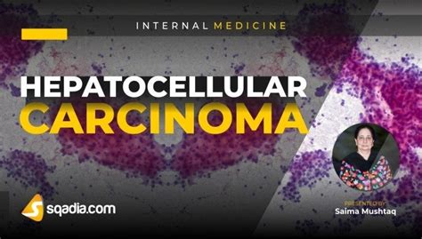 Hepatocellular Carcinoma Internal Medicine Lecture