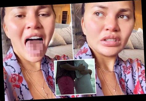 Pregnant Chrissy Teigen Claims She S Eating So Much Sour Candy Her Tongue Is Falling Off