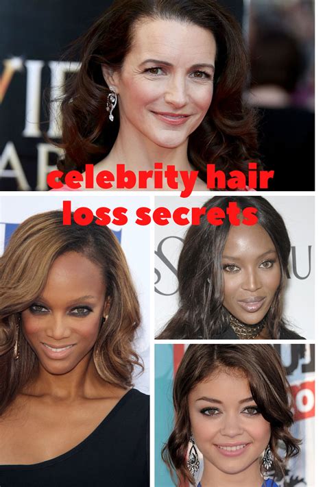 Celebrity Hair Loss Secrets Hair Loss Natural Remedy Why Hair Loss