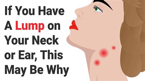 If You Have A Lump On Your Neck Or Ear This May Be Why