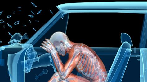 31 full pdfs related to this paper. Human Anatomy In A Car Crash Muscles And Bones Stock Photo ...
