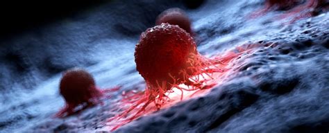 Scientists Destroy 99 Of Cancer Cells In The Lab Using Vibrating