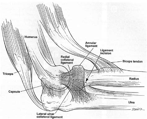 To Avoid Disruption Of The Lateral Ulnar Collateral Ligament With A