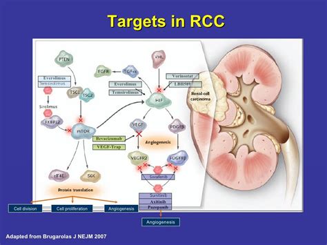 Renal Cell Carcinoma A New Standard Of Care