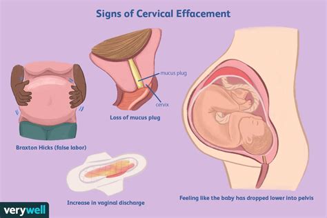Cervix Dilation Chart Signs Stages And Procedure To Check Off