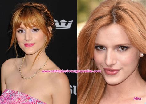Bella Thorne Plastic Surgery For Young Disney Star