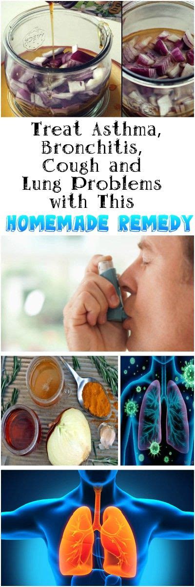 Treat Asthma Bronchitis Cough And Lung Problems With This Homemade