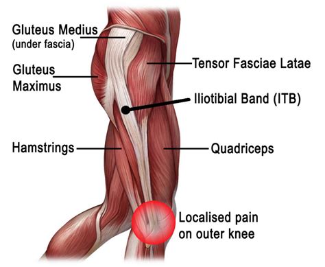 ~located in the middle of the front of the thigh. DIAGNOSE AND CURE YOUR ITB PAIN