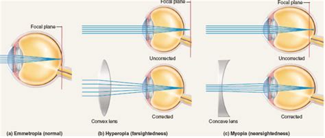 Lenses Are Important In Scatteringconvergediverging Light As Needed