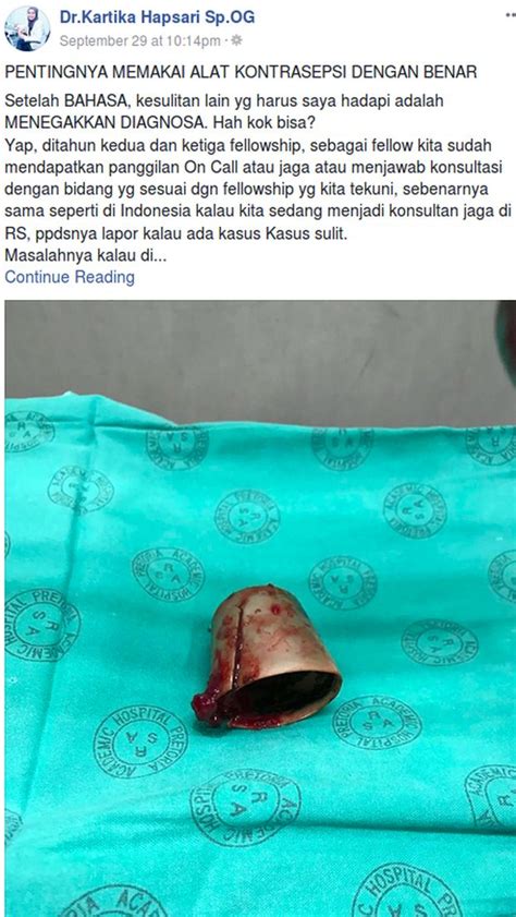 Cerita Viral Dokter Indonesia Temukan Tutup Deodoran Di Miss V