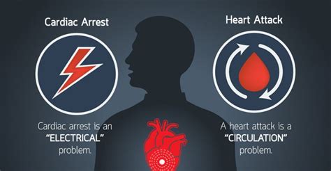 How Does Cardiac Arrest Differ From A Heart Attack Medico Topics News Hub Latest News