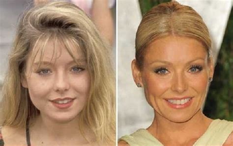 Kelly Ripa Before And After Plastic Surgery Nose Boob Botox Facelift