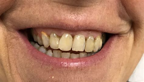 Simple Science: How to Make a Volcano with Kids