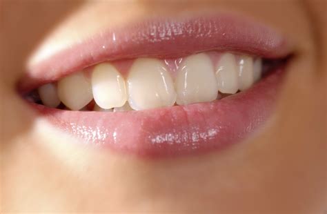 Are Your Teeth Showing Their ‘natural Beauty Violife Smile Designs