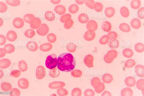 Slide Blood Smear Show Monocyte Stock Photo Download Image Now