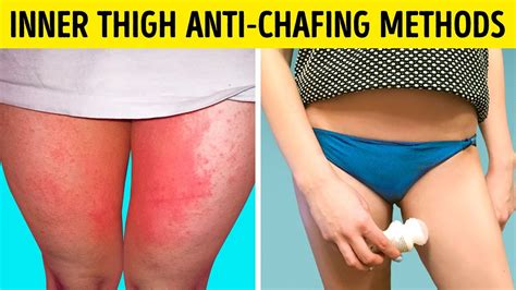 Also find out easy and effective home remedies to get rid of a rash between your legs. I Used These Easy Thigh Anti-Chafing Methods and my Inner ...