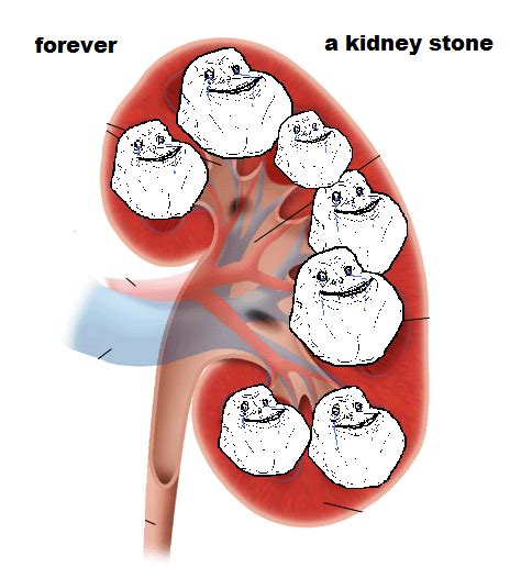 100+ vectors, stock photos & psd files. Kidney Stone Funny Quotes. QuotesGram