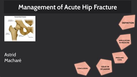 Management Of Acute Hip Fracture By Astrid Machare