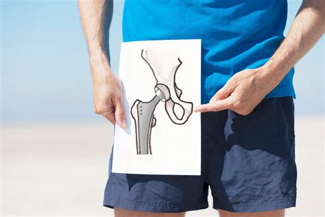 Treating Severe Hip Pain With Hip Replacement