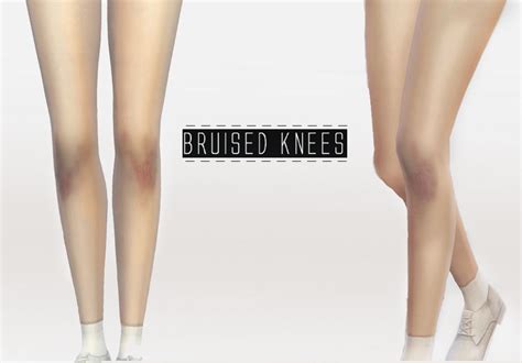Bruised Knees Sims 4 Cc Skin Sims 4 Sims