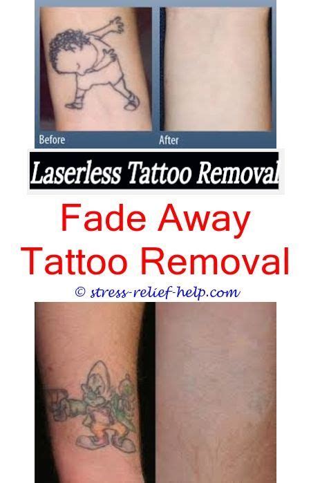 Check spelling or type a new query. Can you fully remove a tattoo.How many sessions to remove ...