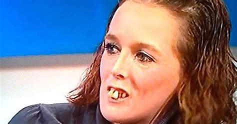 jeremy kyle ‘tooth woman is unrecognisable after £10k dental makeover