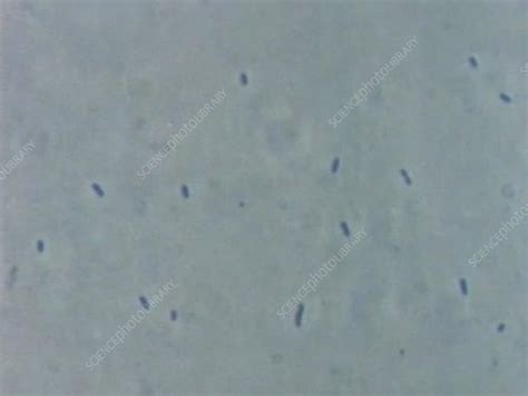 E Coli Bacterial Growth Light Microscopy Stock Video Clip K004