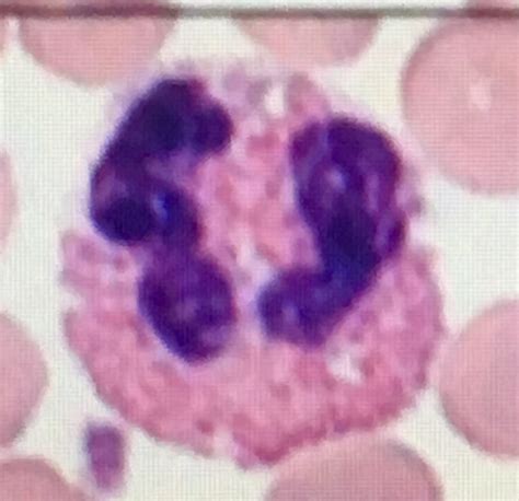 Eosinophil Count Absolute Eosinophil Count