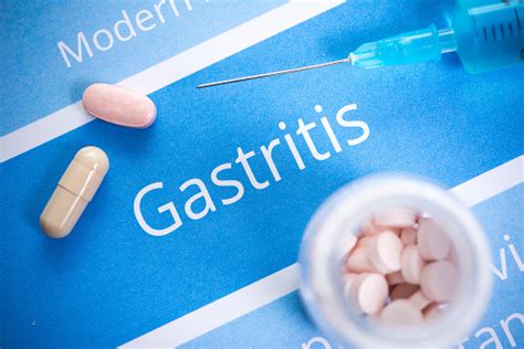Gastritis can be painful, but avoiding certain foods and drinks can help you manage symptoms and prevent the condition from getting worse. Gastritis diet: Foods to eat and avoid, dietary plan and ...
