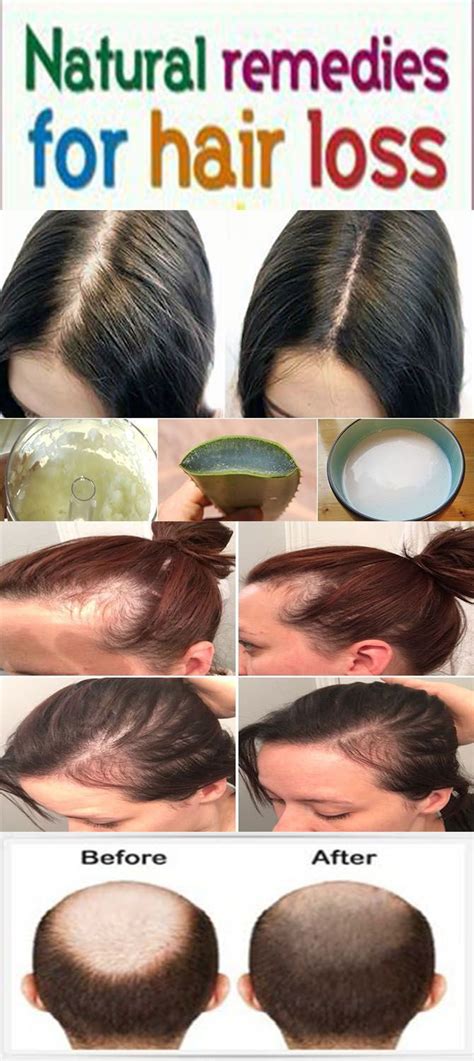 But one can make use of simple and useful indian home remedies to take care of dandruff. How to control hair fall & stop hair fall - home remedies ...