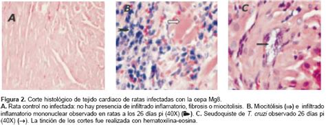 ¿qué aumenta el riesgo de tener miocarditis? Myocardial cellular damage and the activity of the ...