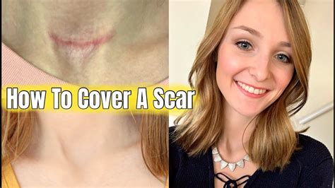 How To Cover A Scar Or Surgical Incision YouTube
